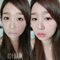 ady200290249