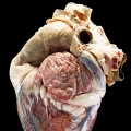 insufficiency
